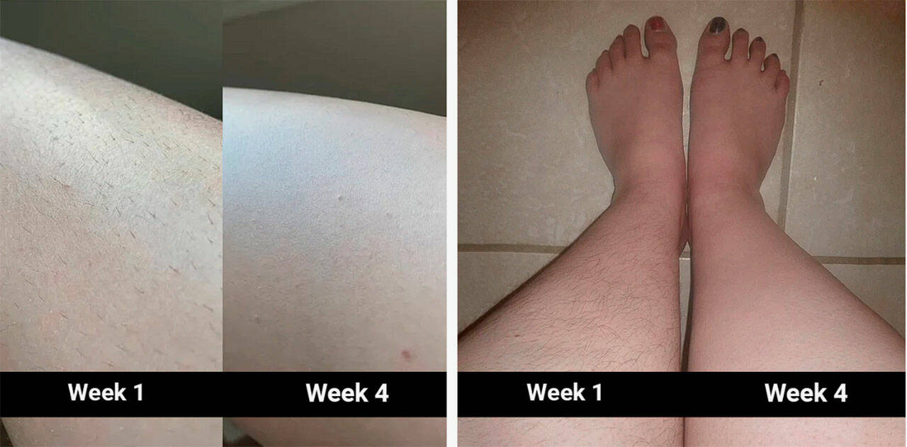 5minskin Laser Hair Removal, … curated on LTK