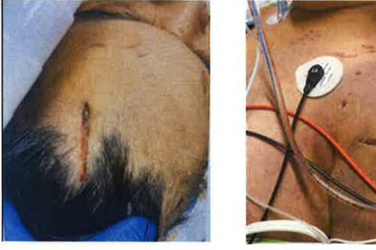 Photographs of Esther Arunong’s injuries. (Photo from court documents)